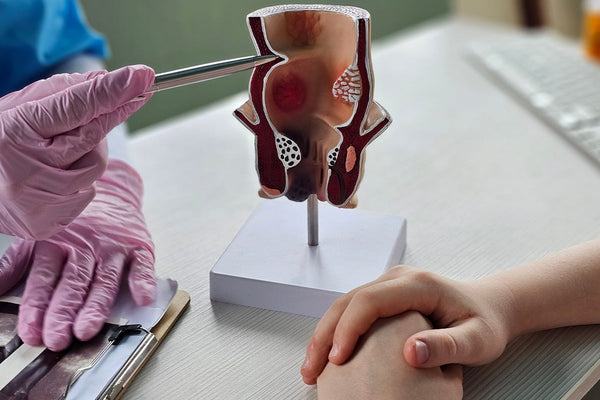 What Shrinks Hemorrhoids Fast: Natural Relief That Actually Works