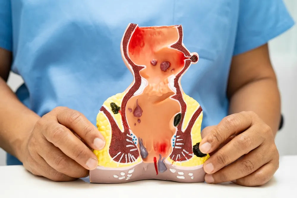  internal hemorrhoid symptoms